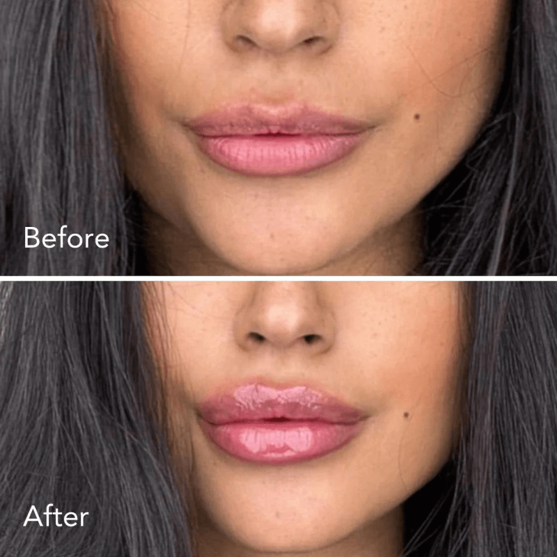 CHLOEE™ Extreme Lip Plumper
